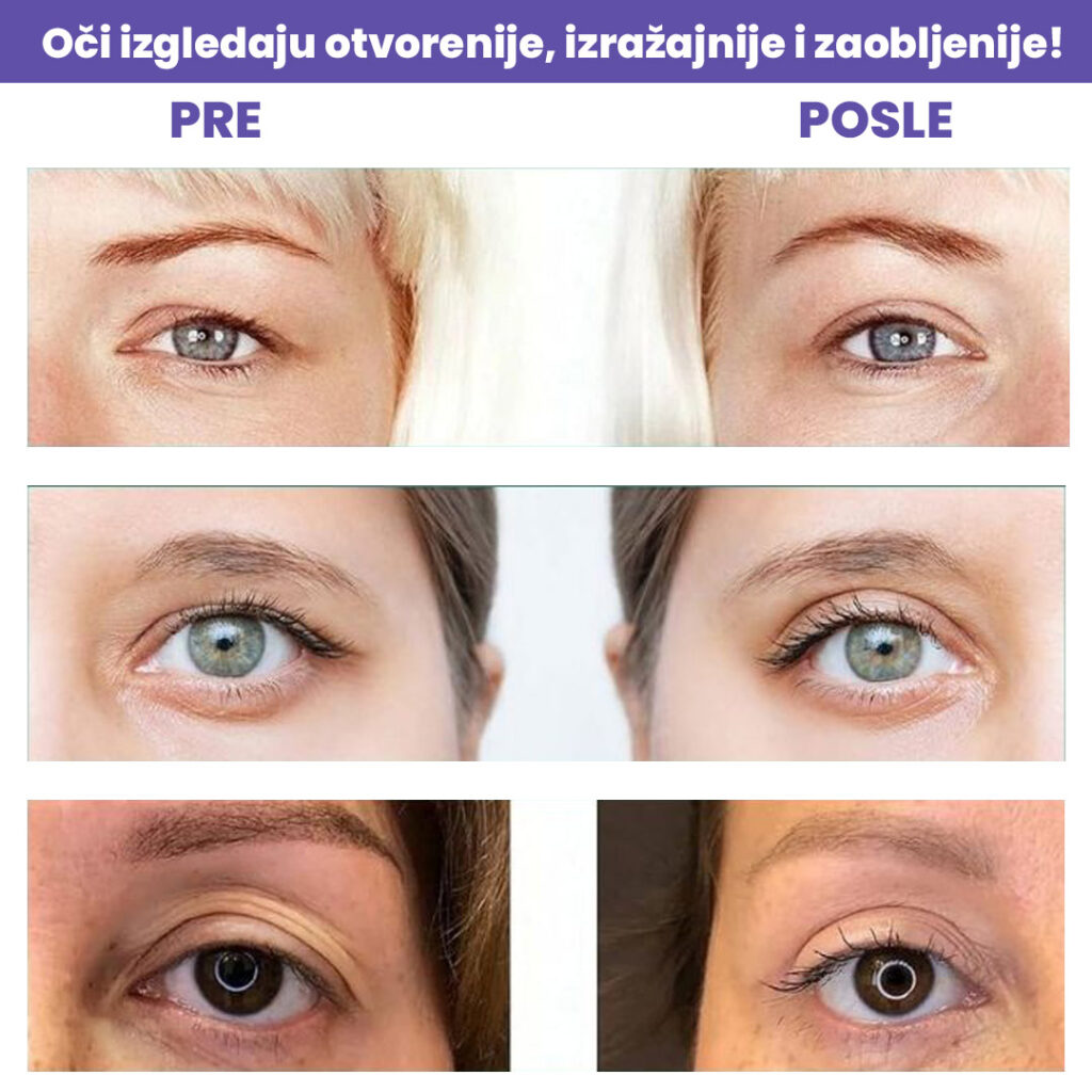 Trake za podizanje kapaka (480 kom)